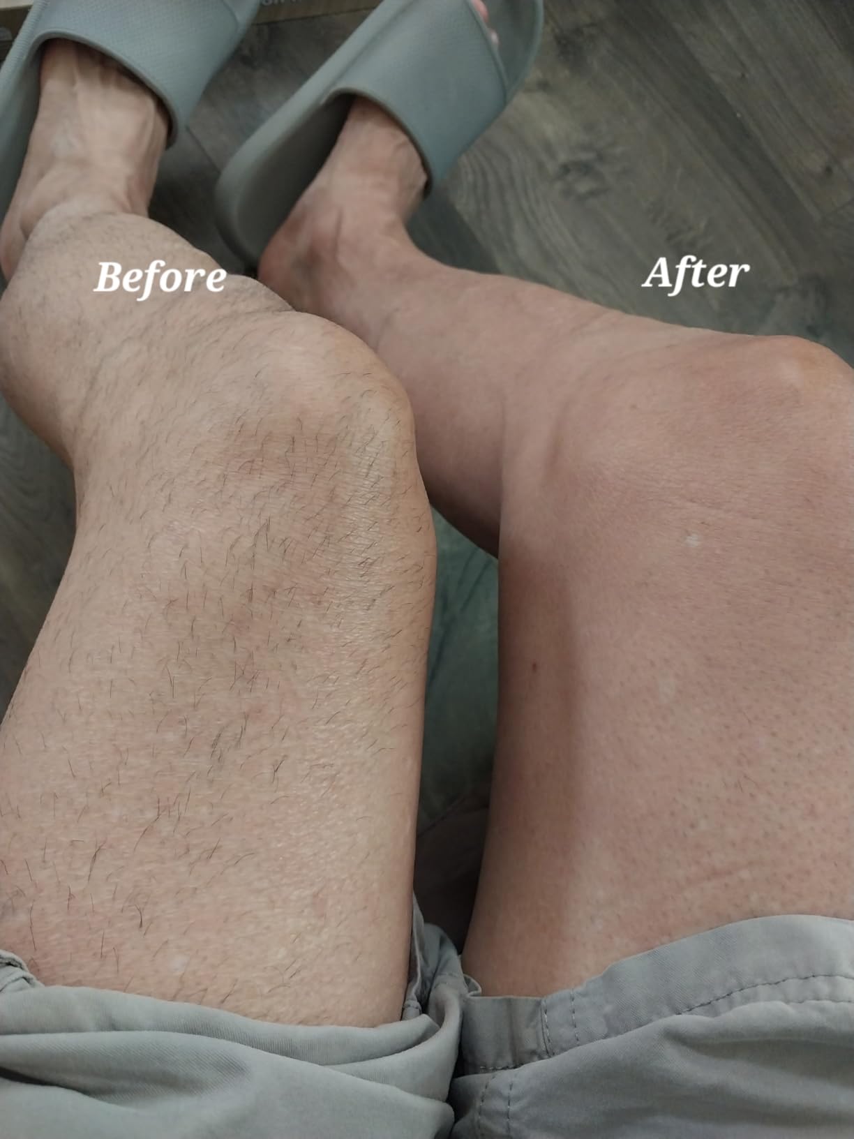 Remington XR7000 Balder Pro Rotary Shaver Rechargeable Waterproof Electric Razor for Men Cordless Lithium Power 5 Dual Track Flexing Heads and Pop-Up Trimmer Black Customer Review Remington XR7000 Balder Pro Rotary Shaver Rechargeable Waterproof Electric Razor for Men Cordless Lithium Power 5 Dual Track Flexing Heads and Pop-Up Trimmer Black - Customer Photo 2